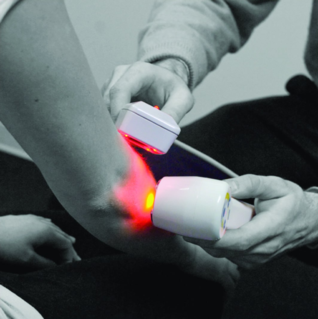 Cold laser therapy